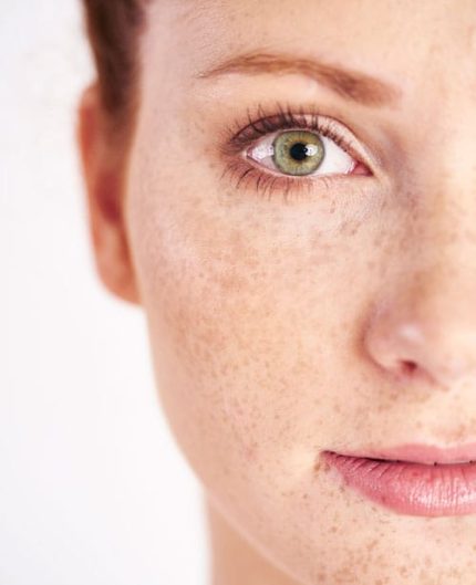 forskellige-hudtyper-behandles-hos-TheLook-i-Århus