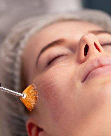 frugtsyre-behandling-hos-thelook-i-Århus