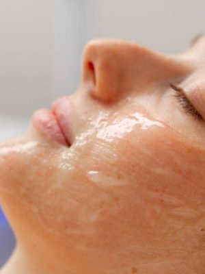 frugtsyre-behandling-hos-thelook-i-Århus2